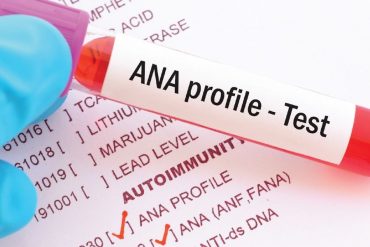 ANA Profile Test