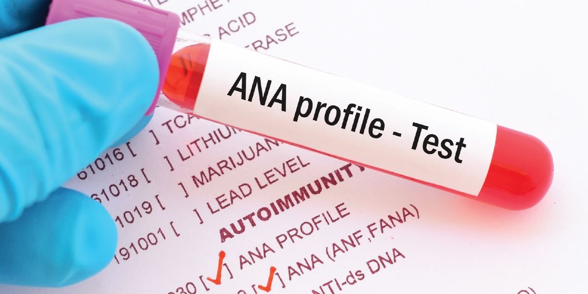 ANA Profile Test