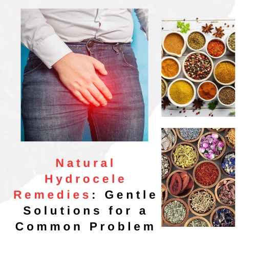 Natural Hydrocele Remedies