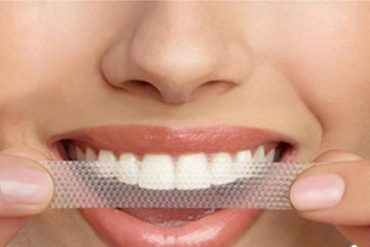 Shine bright with a whiter smile.