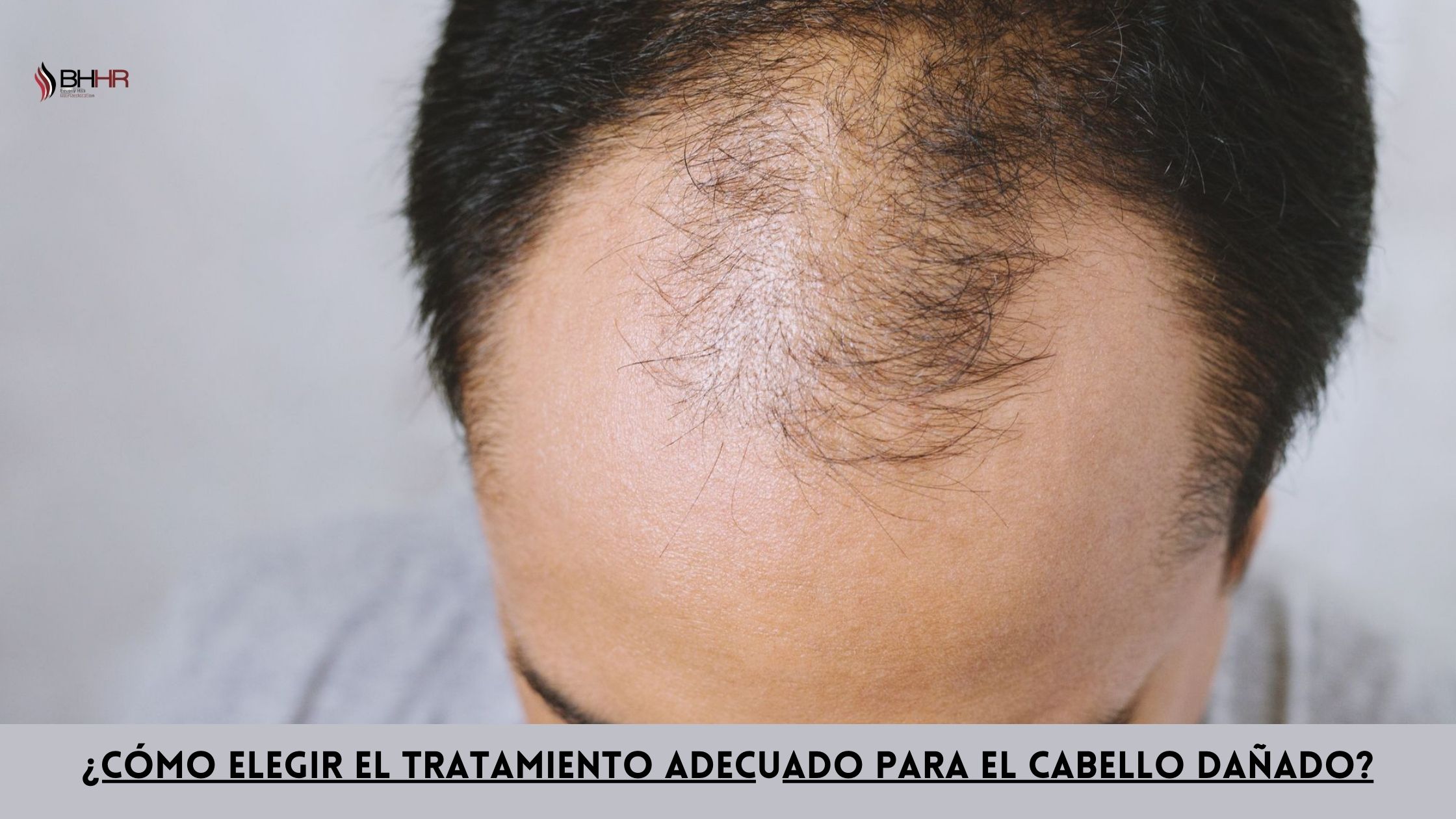 Tratamiento Para El Cabello Maltratado