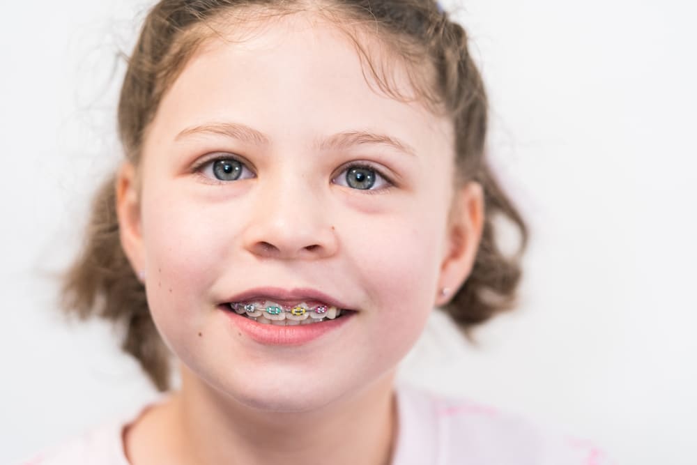 What-to-Expect-in-Your-First-Week-with-Braces