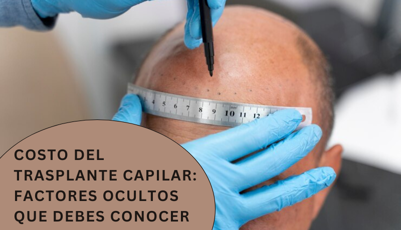 cuanto cuesta un injerto de cabello