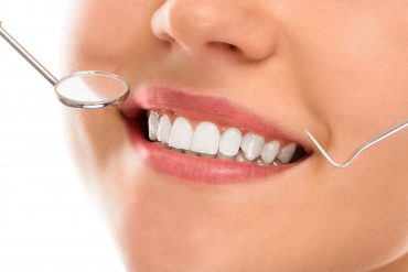 Cosmetic Dentistry for Special Occasions Weddings, Photoshoots, and More