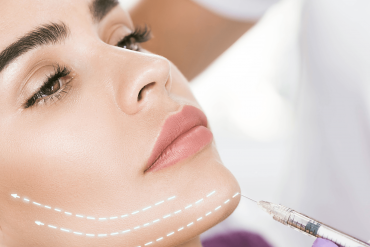 Filler Injections for Chin Enhancement Creating a Balanced Profile