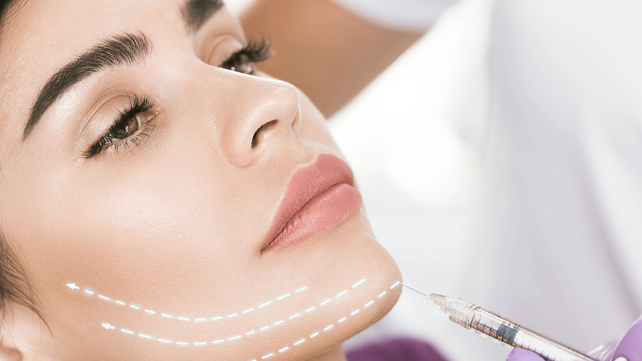 Filler Injections for Chin Enhancement Creating a Balanced Profile