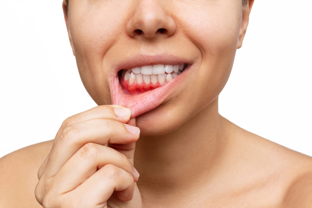 Understanding the Risks and Complications of Gum Contouring